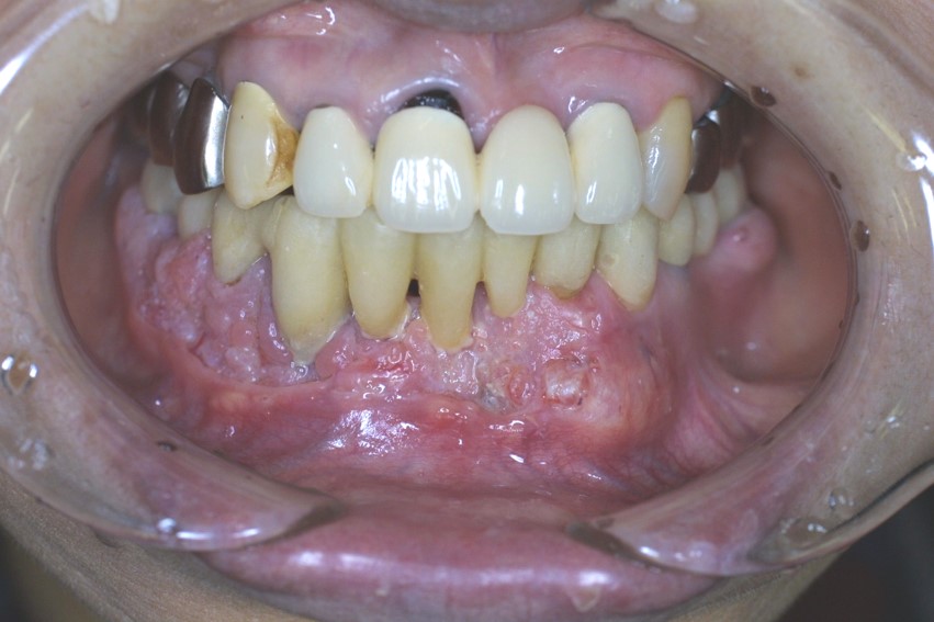 原因不明の歯のぐらつきが３週間以上続いている