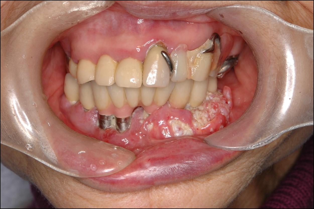 原因不明の歯のぐらつきが３週間以上続いている