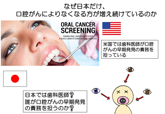 なぜ日本だけ口腔がんで死亡する人が増えているのか