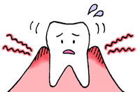 辺縁性歯周炎